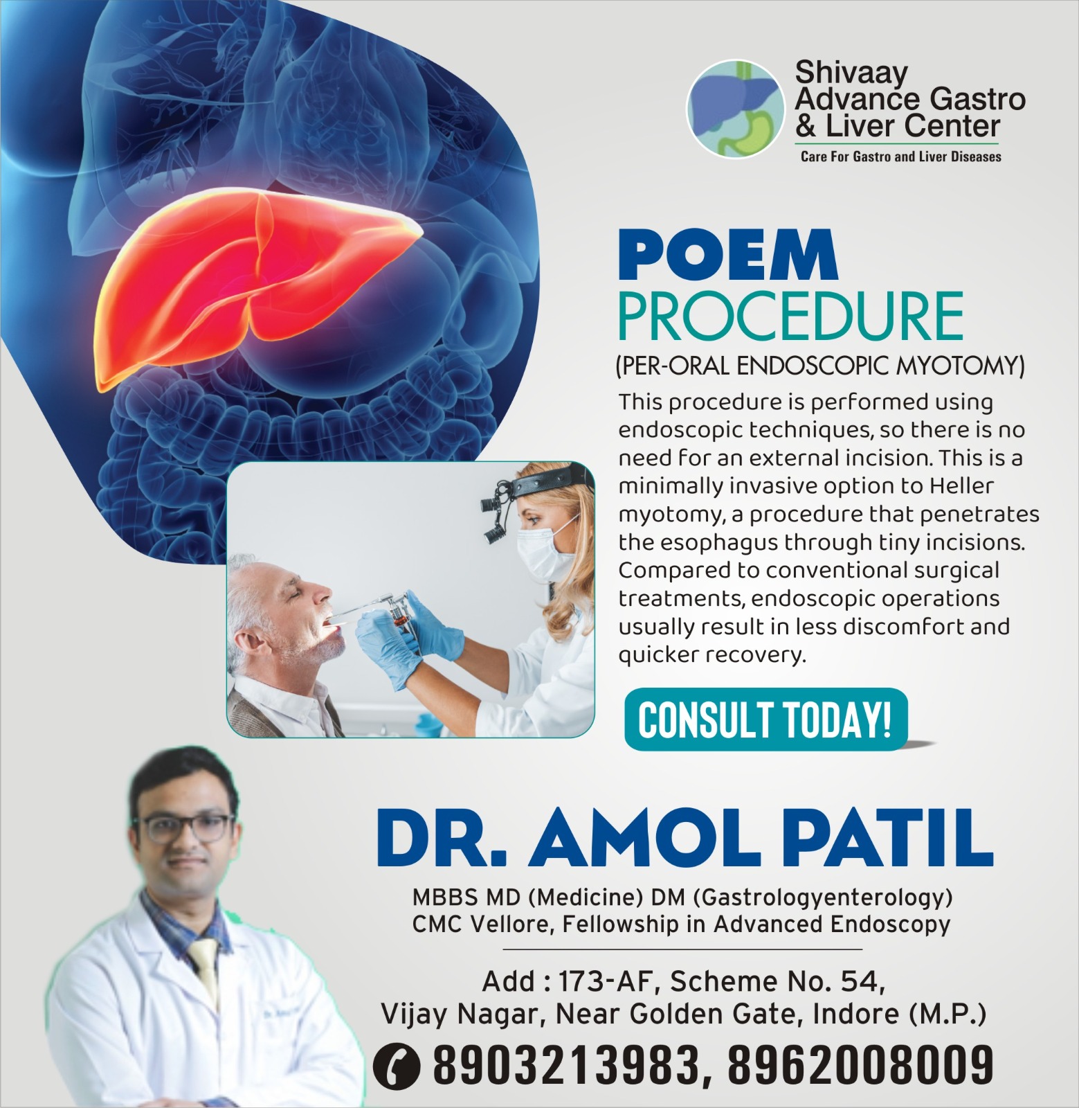 Best Doctor For POEM Treatment in Indore